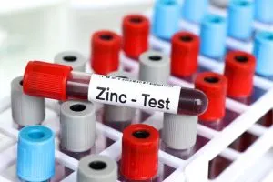 Des analyses de sanguin pour tester  les niveaux de zinc.